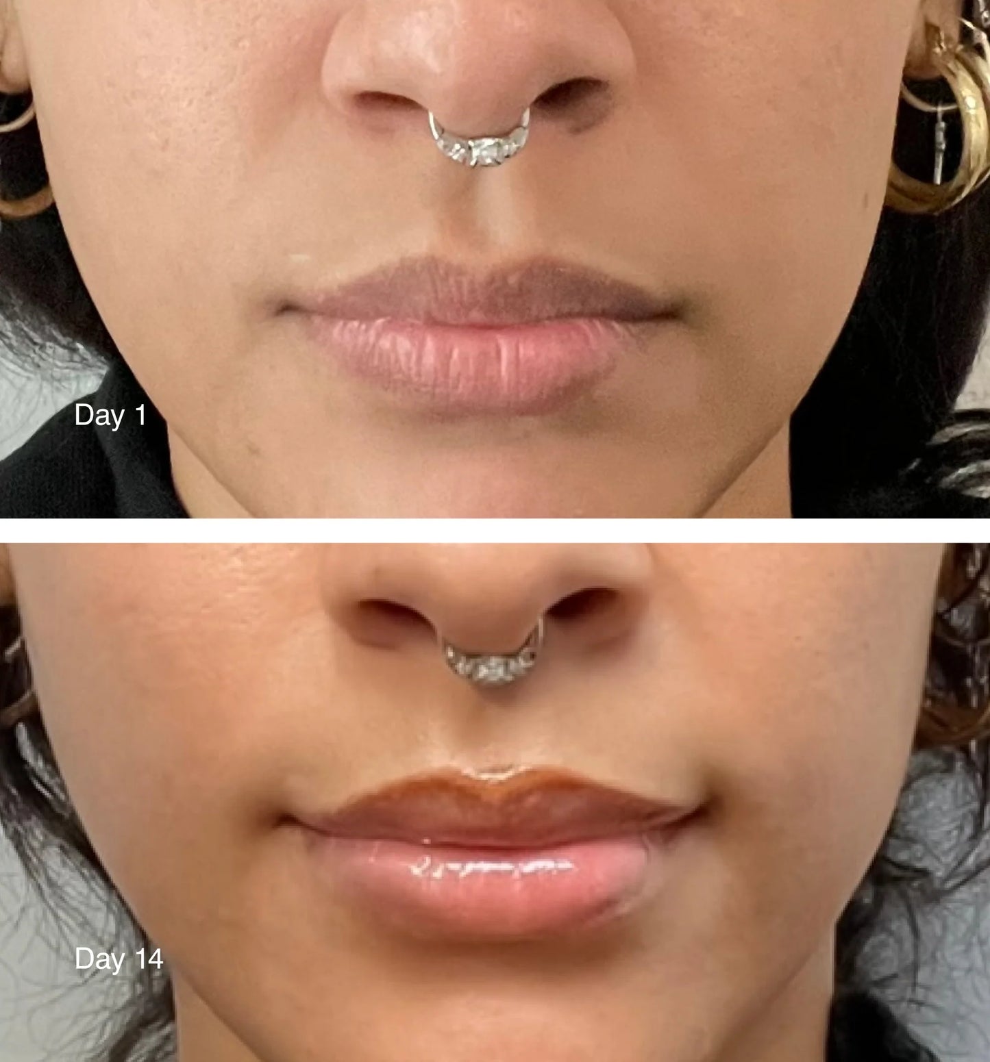 Peptide Lip-Treatment